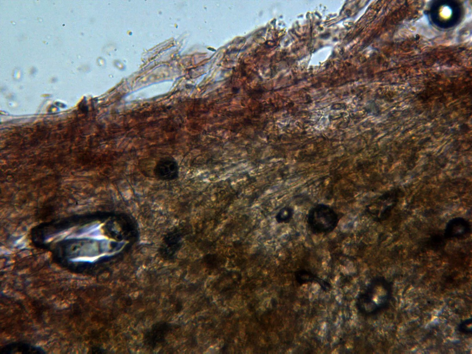 Microscopía de Rhizopogon luteolus - 12 - Peridio externo x 400